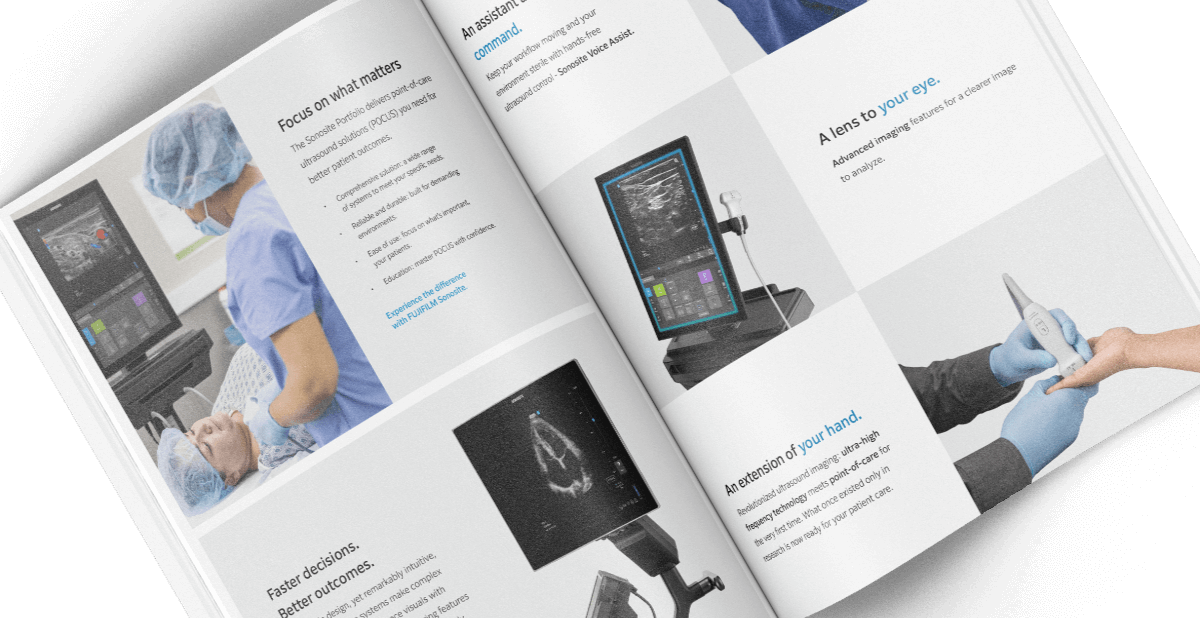 Sonosite brochures