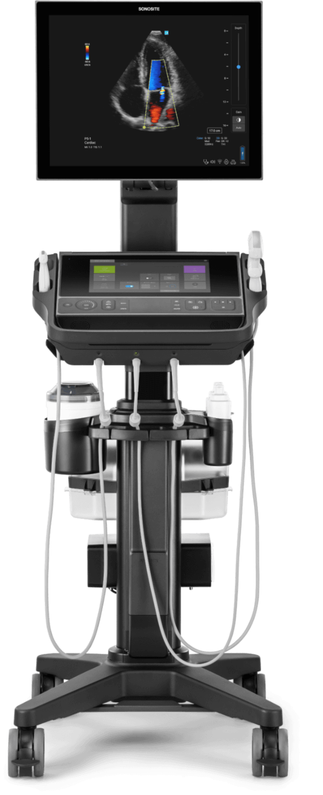 Sonosite machine